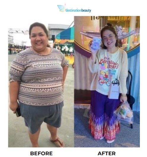 alisa beal weight loss Image 7